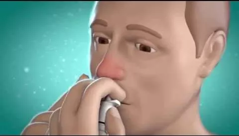 Vídeo sobre NASIC Spray nasal, 10 ml