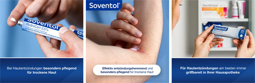 SOVENTOL Hydrocort 0,5% creme, 30 g