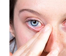 HYLO DUAL Colírio para os olhos, 10 ml