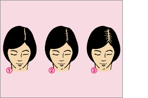 [mulheres 20 mg/ml spray, 60 ml