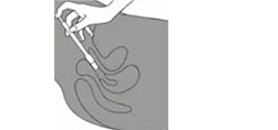CLOTRIMAZOL AL 200 comprimidos vaginais, 3 unid