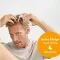 Instructions for use for Minoxidil BIO-H-TIN-Pharma 50 mg/ml spray para homens, 3X60 ml - 5