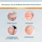 Solução EndWarts® CLASSIC , 3 ml