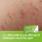 Loratadina axicur® comprimidos de 10 mg, 7 unidades