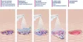 Instructions for use for Spray para limpeza de feridas MediGel®, 50 ml - 6