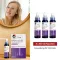 MINOXIDIL DoppelherzPhar.20mg/ml Lsg.Anw.Haut Frau, 3X60 ml